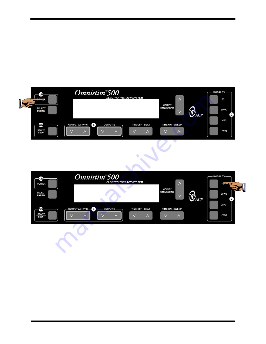 ACP OMNISTIM 500A Скачать руководство пользователя страница 51