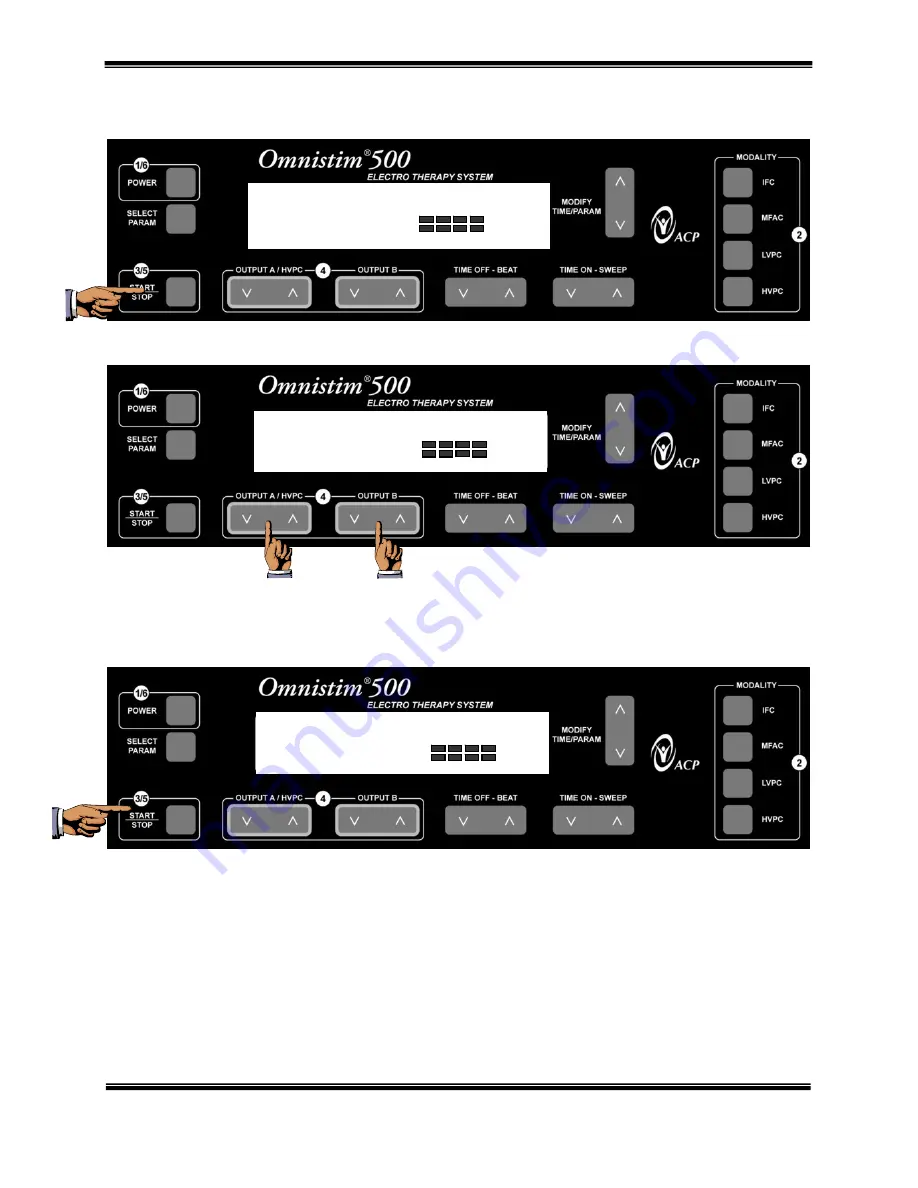 ACP OMNISTIM 500A Скачать руководство пользователя страница 52