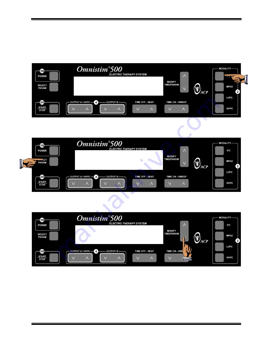 ACP OMNISTIM 500A User Manual Download Page 54