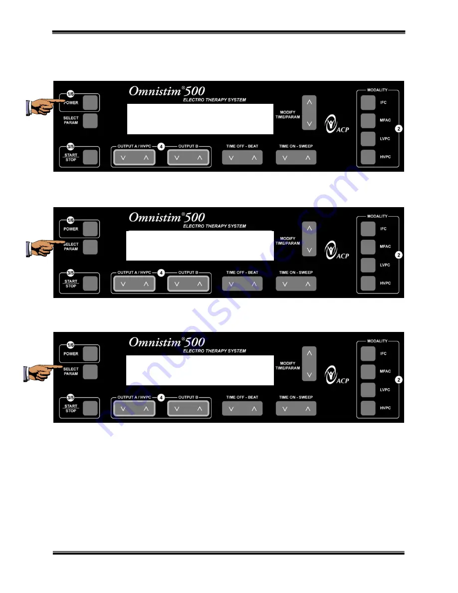 ACP OMNISTIM 500A Скачать руководство пользователя страница 59