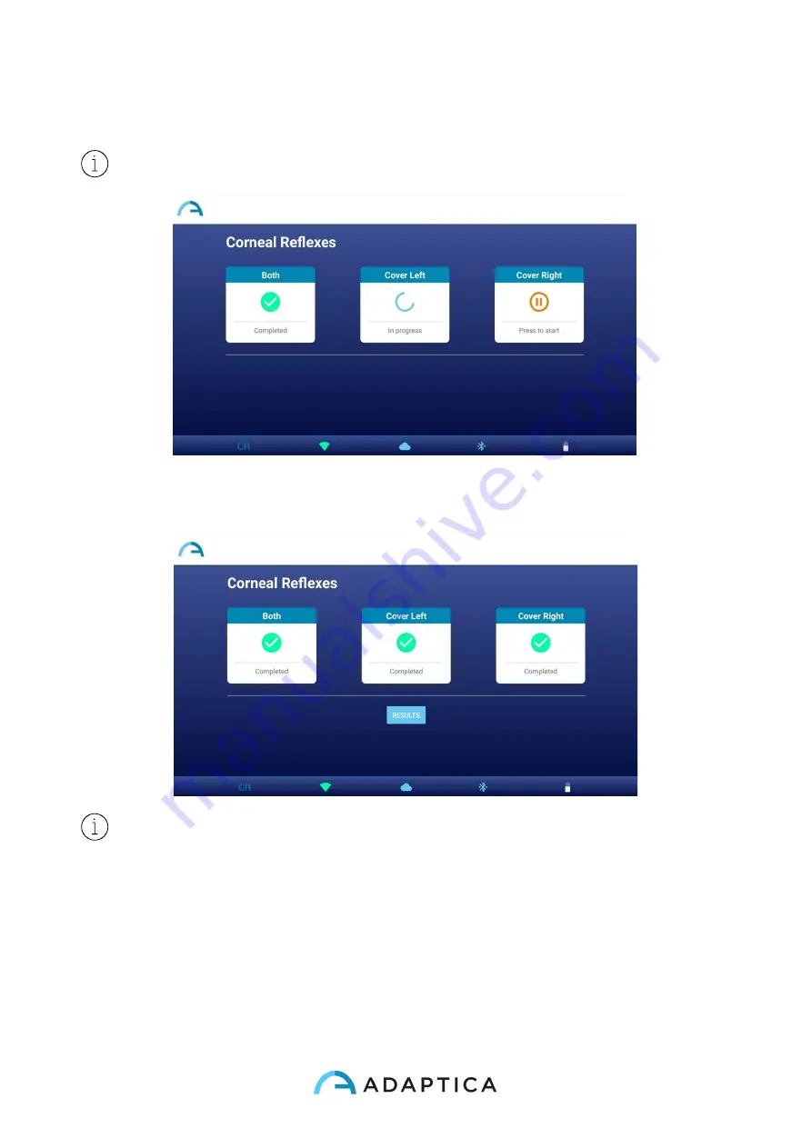 Adaptica 2WIN-S Скачать руководство пользователя страница 44