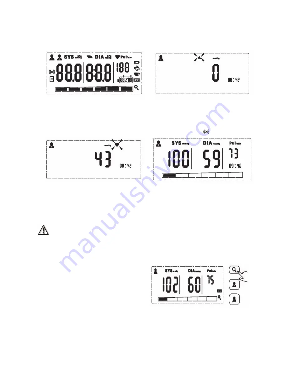 ADE adeVital Pressure BPM1401 Operating Instructions Manual Download Page 12