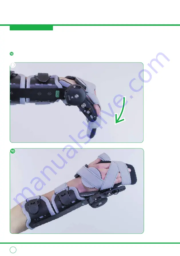 Albrecht CDS WRIST BRACE EXTENSION User Instructions Download Page 30