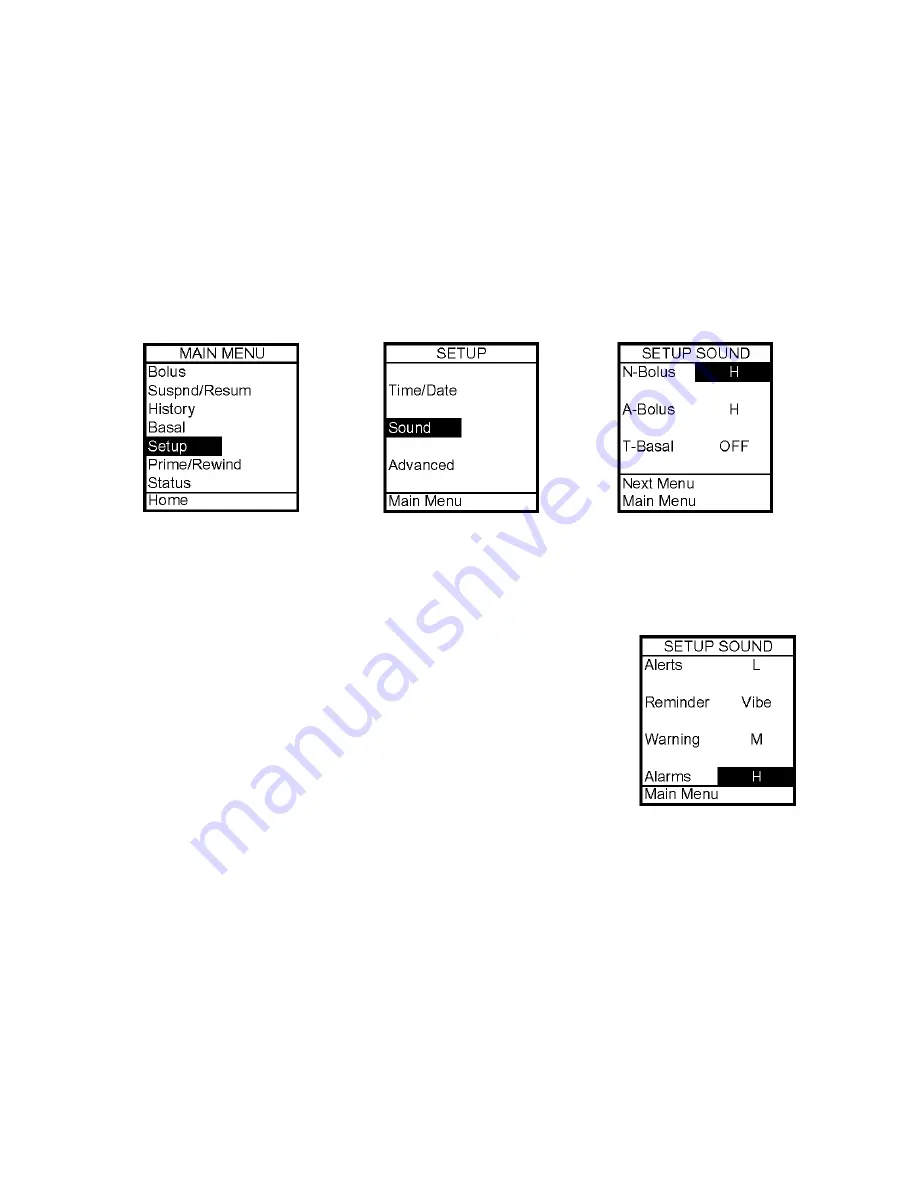 Animas IR 1250 User Manual Download Page 29