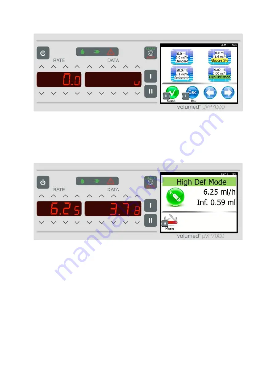 Arcomed Volumed uVP7000 Premium Скачать руководство пользователя страница 20