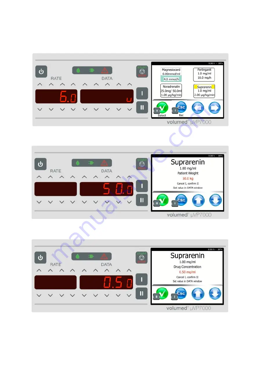 Arcomed Volumed uVP7000 Premium Скачать руководство пользователя страница 23