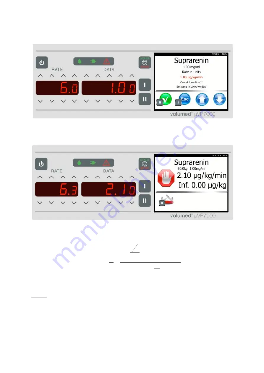 Arcomed Volumed uVP7000 Premium Скачать руководство пользователя страница 24