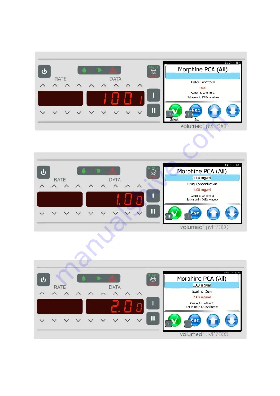 Arcomed Volumed uVP7000 Premium Скачать руководство пользователя страница 26