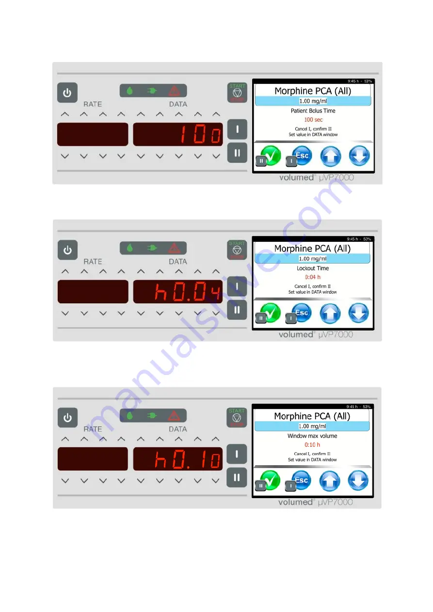 Arcomed Volumed uVP7000 Premium Скачать руководство пользователя страница 28