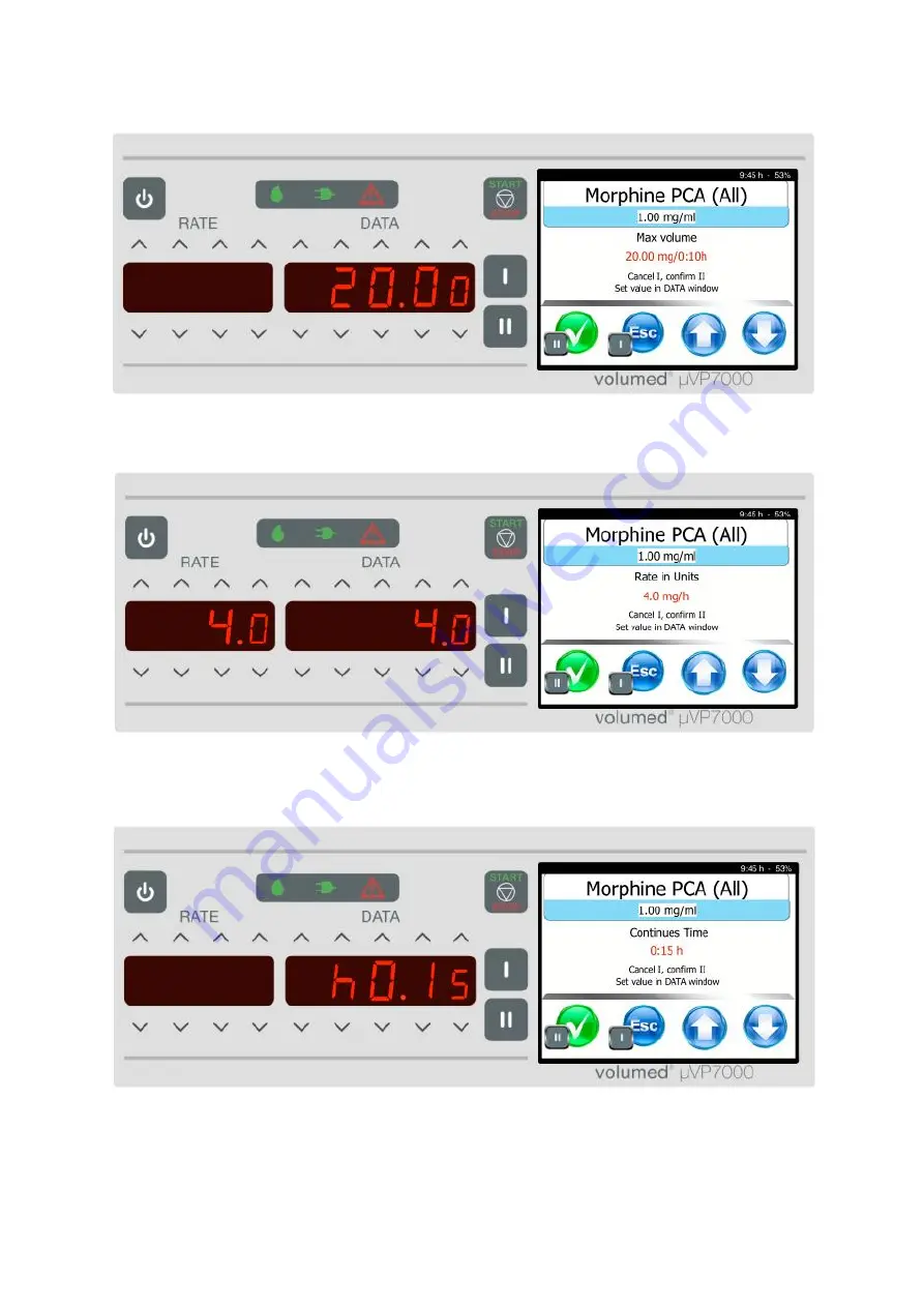 Arcomed Volumed uVP7000 Premium Скачать руководство пользователя страница 29