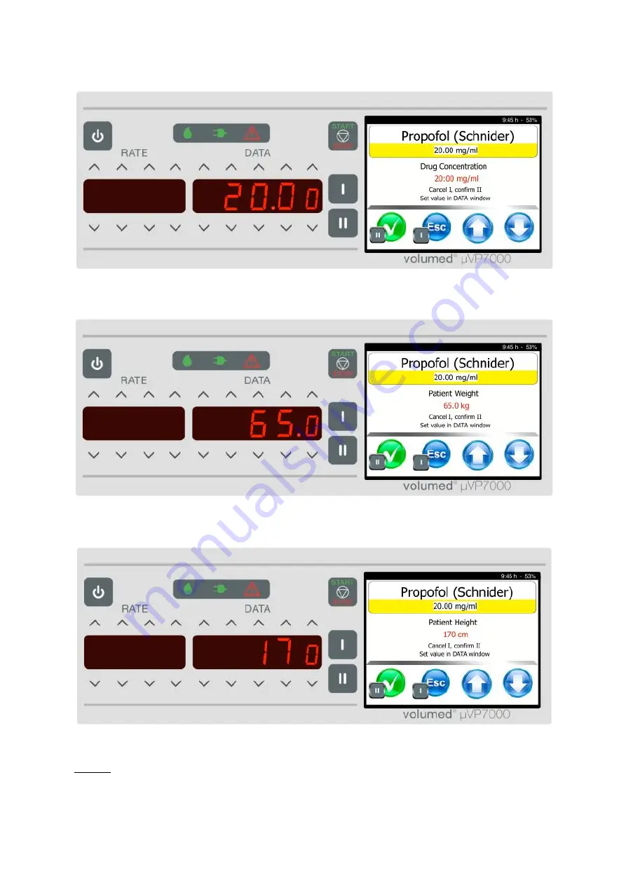 Arcomed Volumed uVP7000 Premium Скачать руководство пользователя страница 32