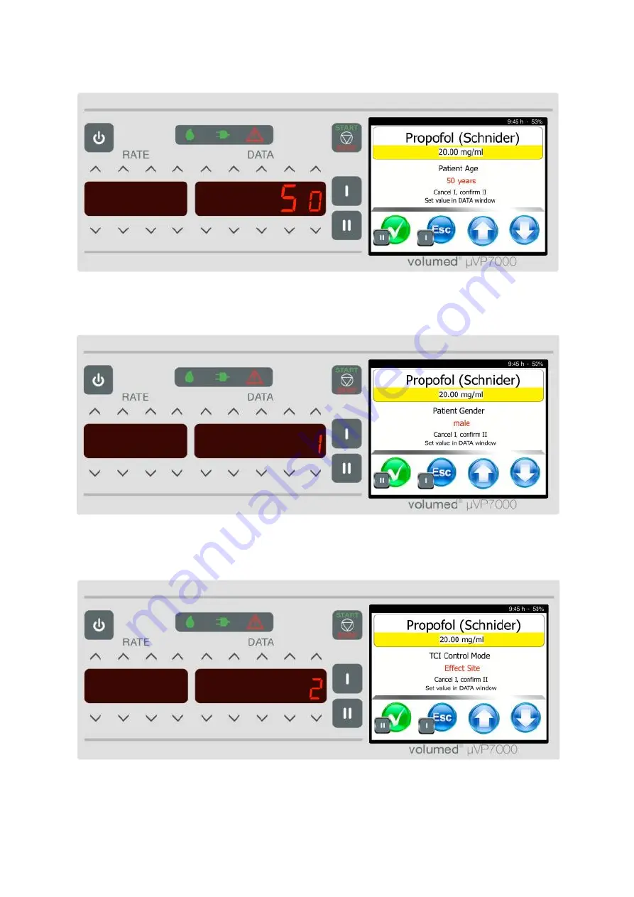 Arcomed Volumed uVP7000 Premium Скачать руководство пользователя страница 33