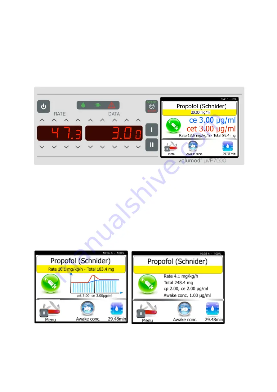 Arcomed Volumed uVP7000 Premium User Manual Download Page 35