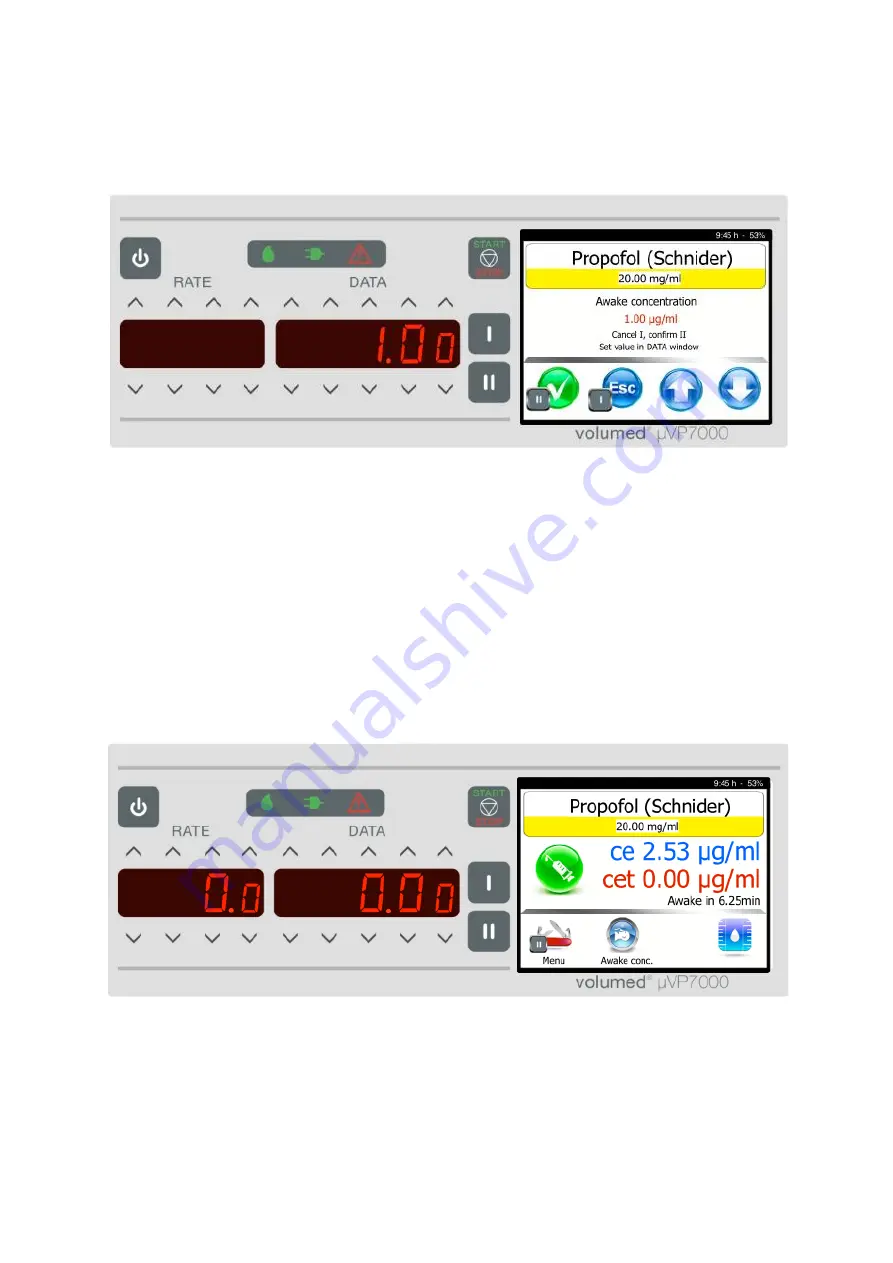 Arcomed Volumed uVP7000 Premium Скачать руководство пользователя страница 36