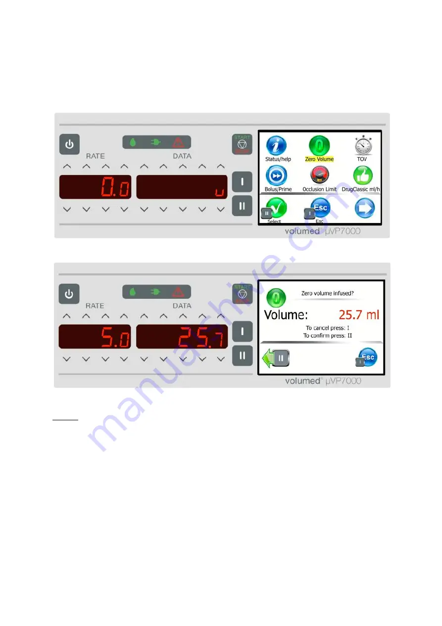 Arcomed Volumed uVP7000 Premium Скачать руководство пользователя страница 38