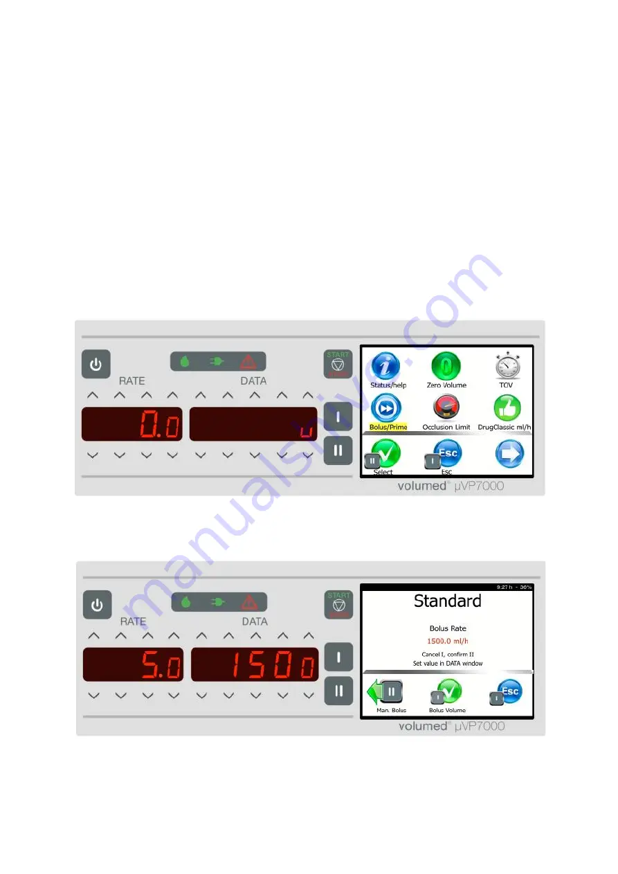 Arcomed Volumed uVP7000 Premium Скачать руководство пользователя страница 39