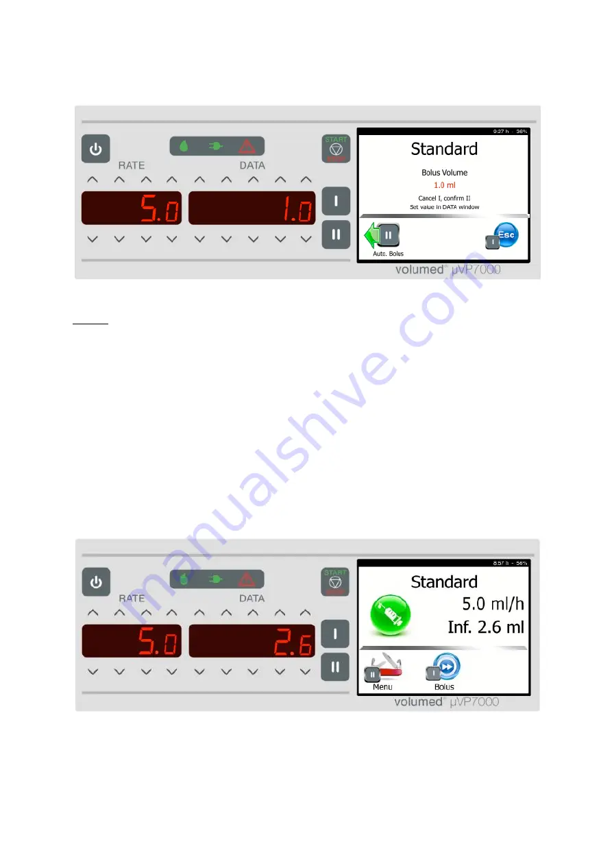 Arcomed Volumed uVP7000 Premium Скачать руководство пользователя страница 40