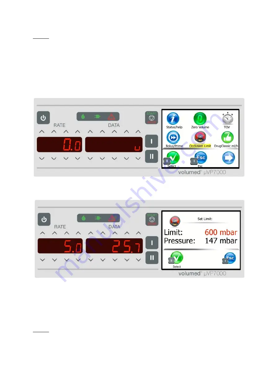 Arcomed Volumed uVP7000 Premium Скачать руководство пользователя страница 42