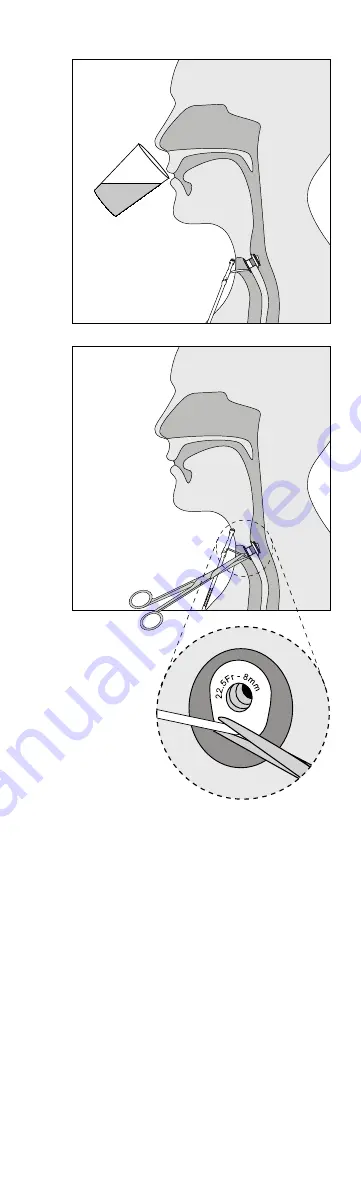 Atos Medical Provox Vega XtraSeal Скачать руководство пользователя страница 5