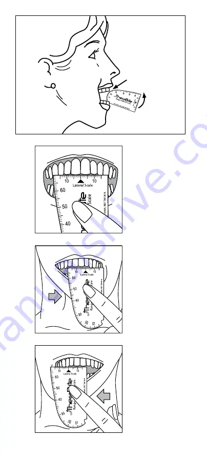 Atos Medical TheraBite Manual Download Page 4