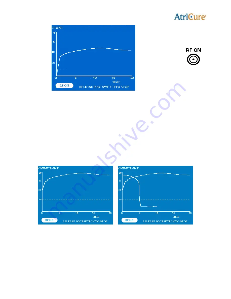 AtriCure ASU2-115 User Manual Download Page 27