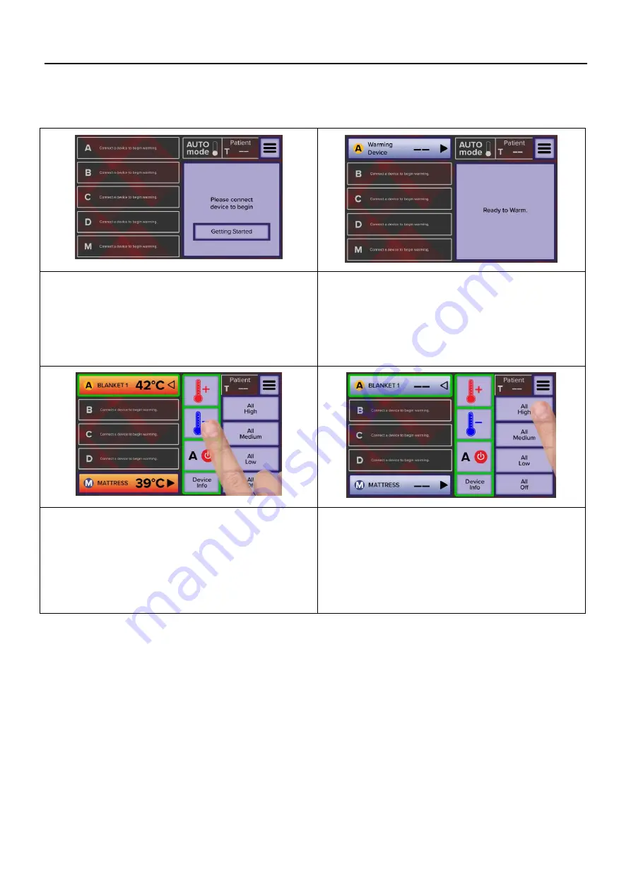 Augustine Surgical HotDog WC7 Series User And Technical Manual Download Page 7