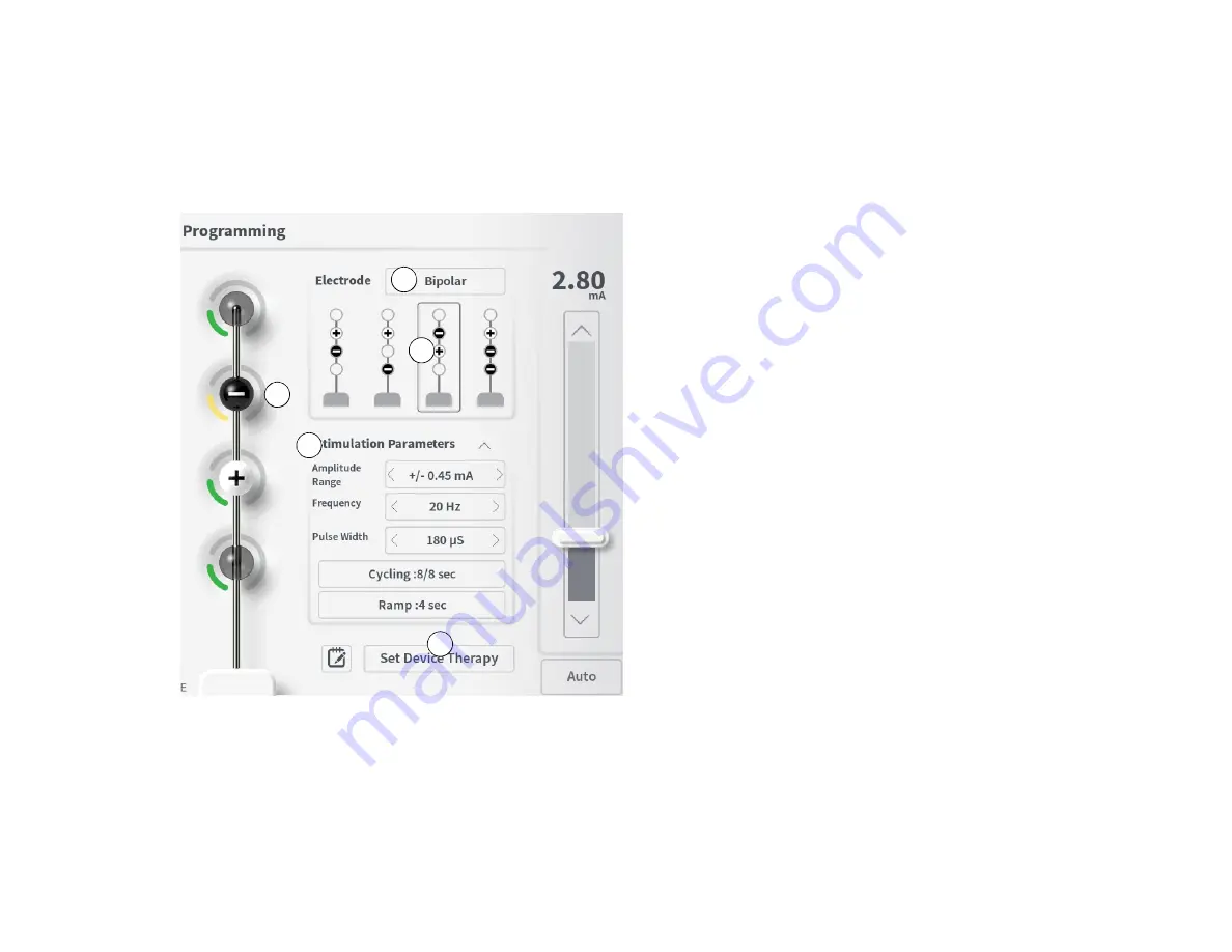 Axonics 1501 Скачать руководство пользователя страница 51