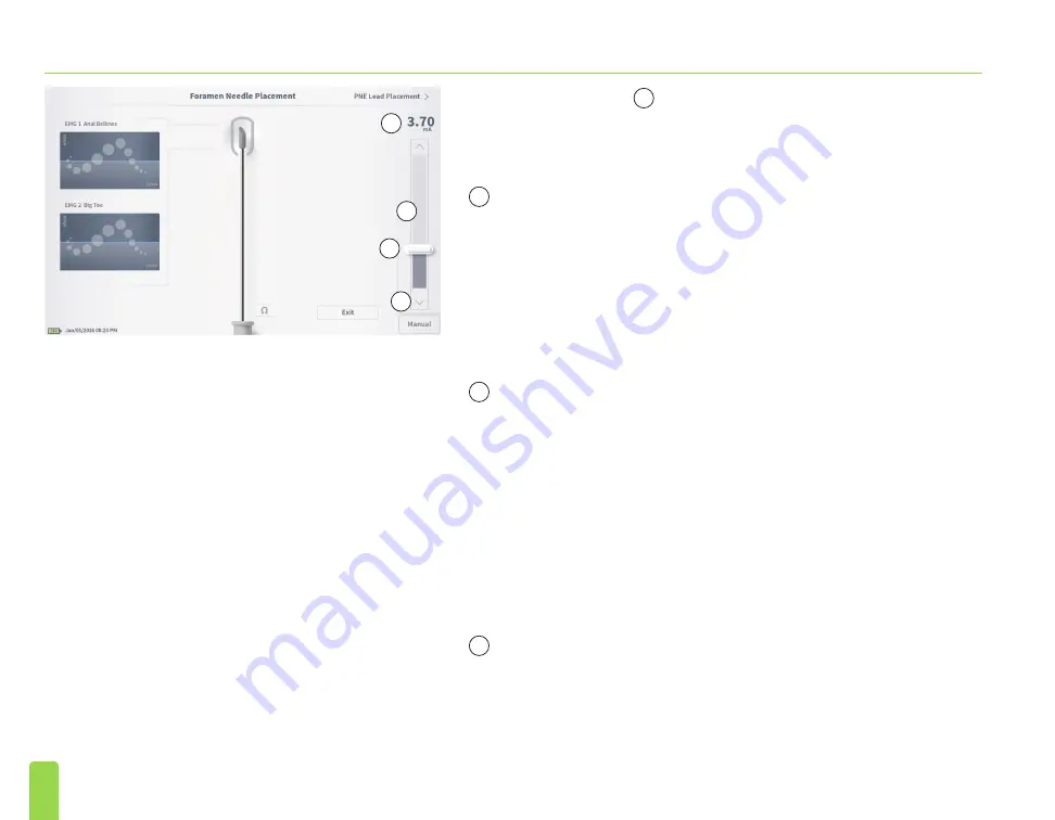 Axonics SNM System 2501 Programmer'S Manual Download Page 24