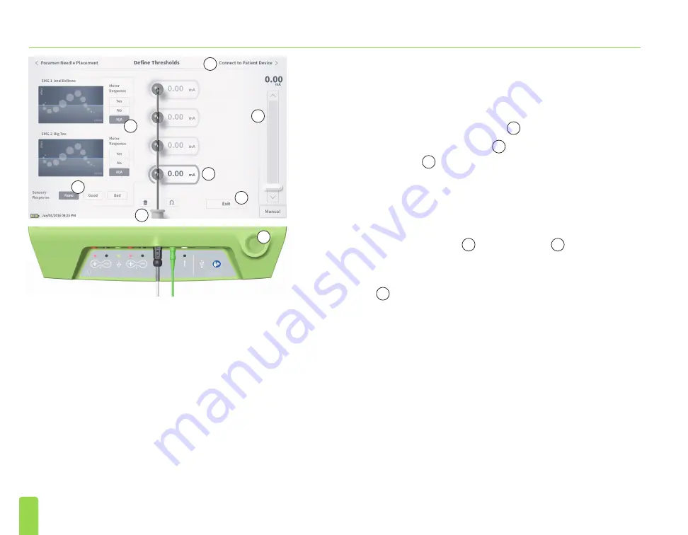 Axonics SNM System 2501 Скачать руководство пользователя страница 34