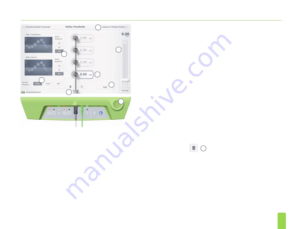 Axonics SNM System 2501 Скачать руководство пользователя страница 35