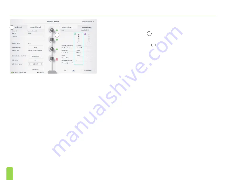 Axonics SNM System 2501 Programmer'S Manual Download Page 44