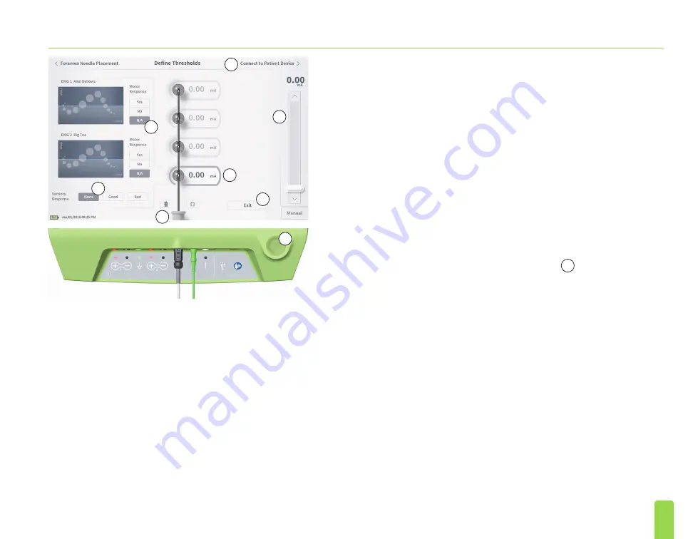 Axonics SNM System 2501 Скачать руководство пользователя страница 99