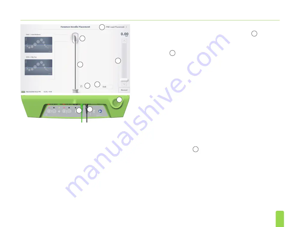 Axonics SNM System 2501 Programmer'S Manual Download Page 161