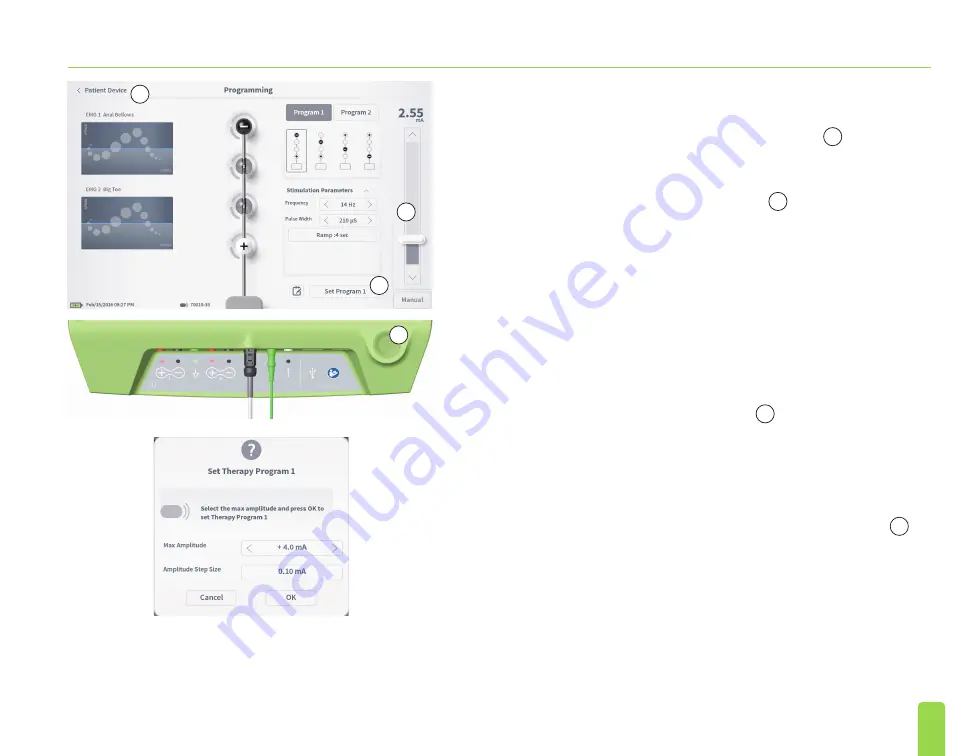 Axonics SNM System 2501 Programmer'S Manual Download Page 189