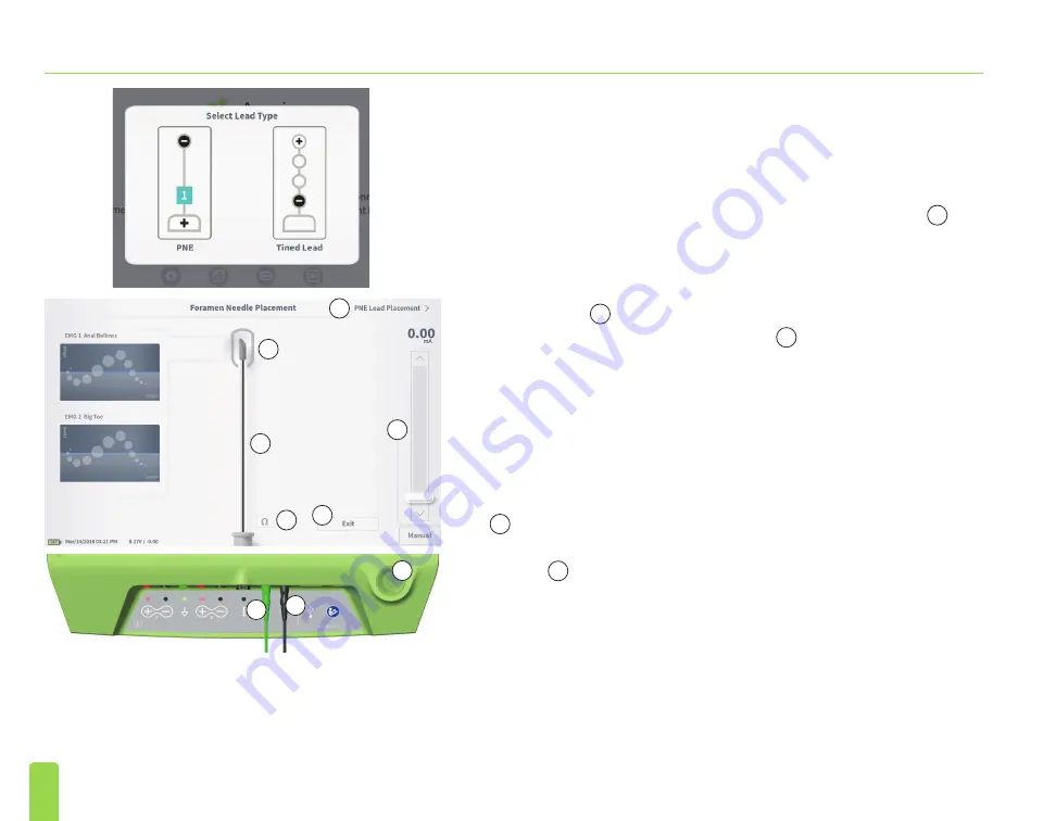 Axonics SNM System 2501 Скачать руководство пользователя страница 292