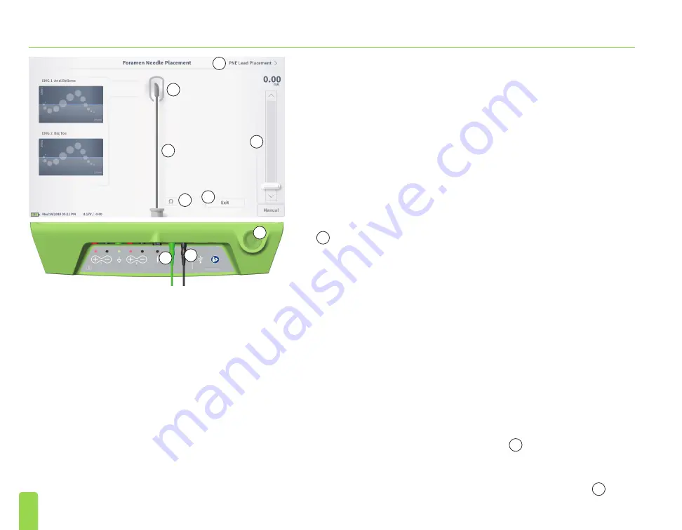 Axonics SNM System 2501 Programmer'S Manual Download Page 296