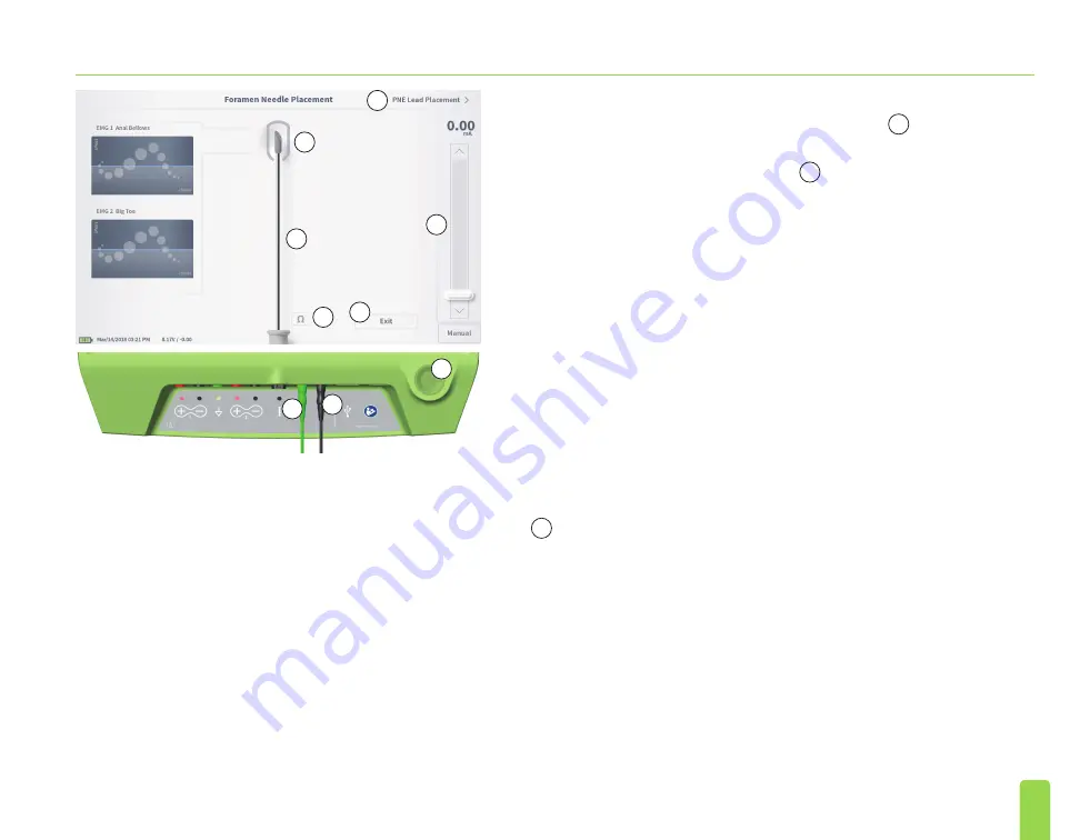 Axonics SNM System 2501 Programmer'S Manual Download Page 359