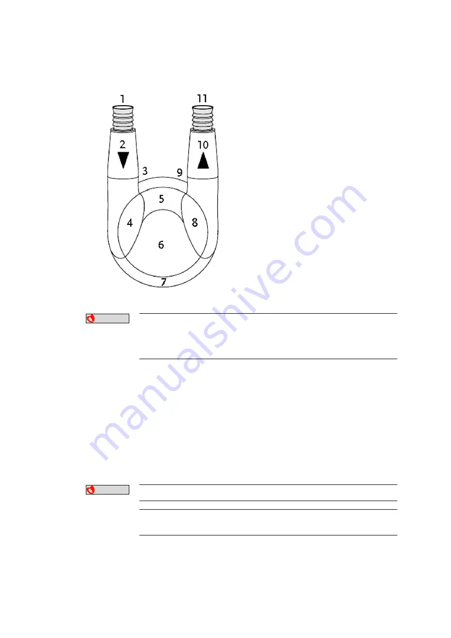 Berlin Heart EXCOR Pediatric VAD Manual Download Page 153