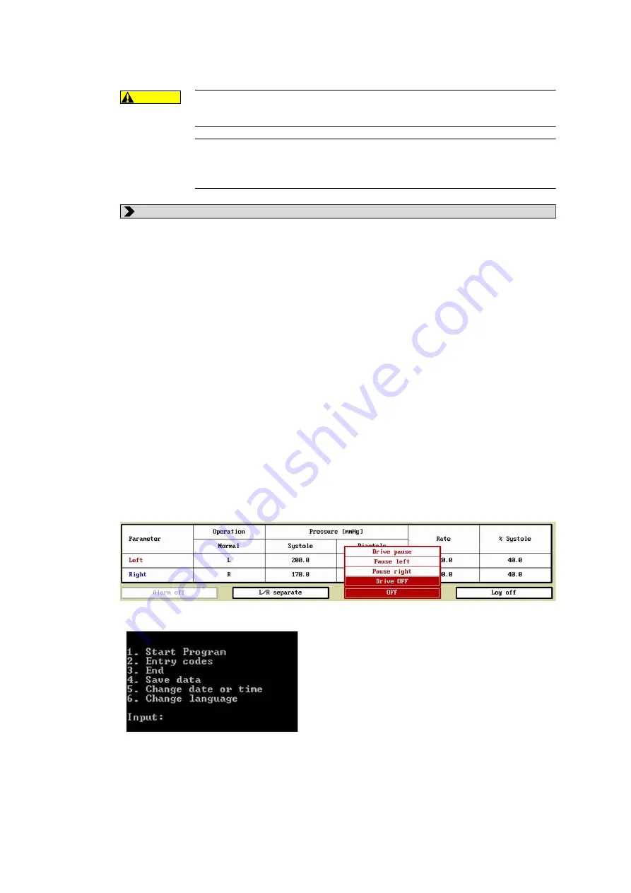 Berlin Heart EXCOR Pediatric VAD Manual Download Page 179