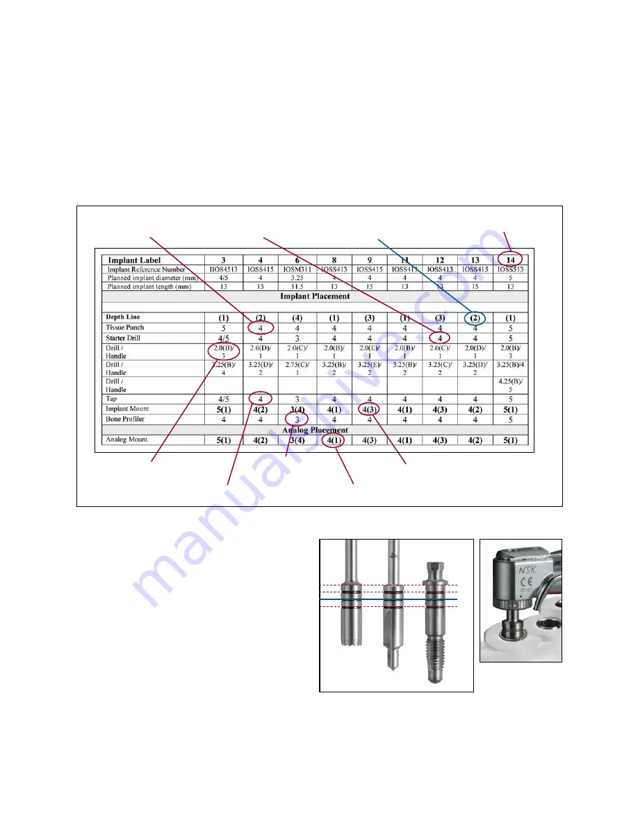 Biomet 3i Navigator Procedures Manual Download Page 12