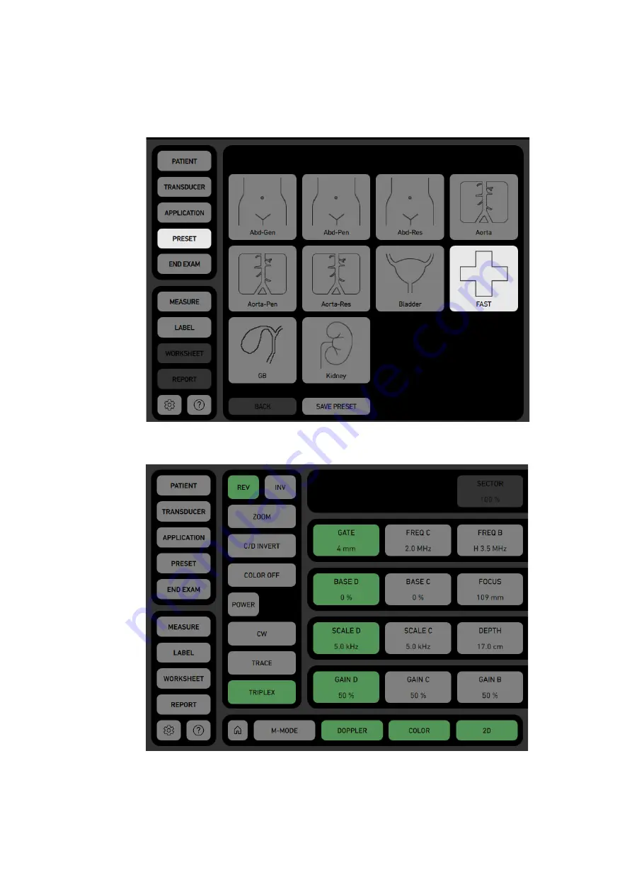 bk ultrasound bk3500 User Manual Download Page 20