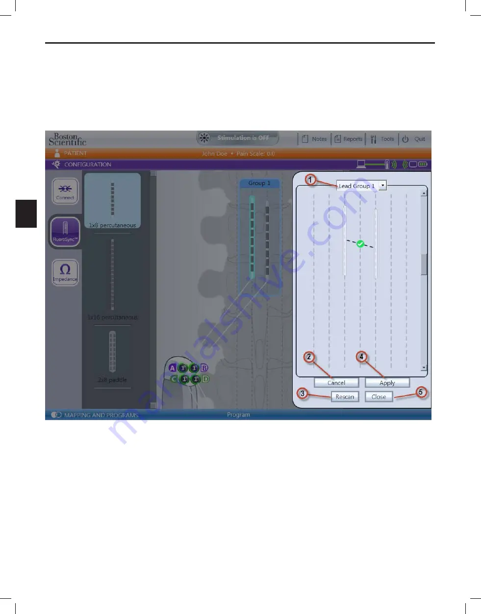 Boston Scientific Bionic Navigator 3d NM-7153-11A Скачать руководство пользователя страница 110