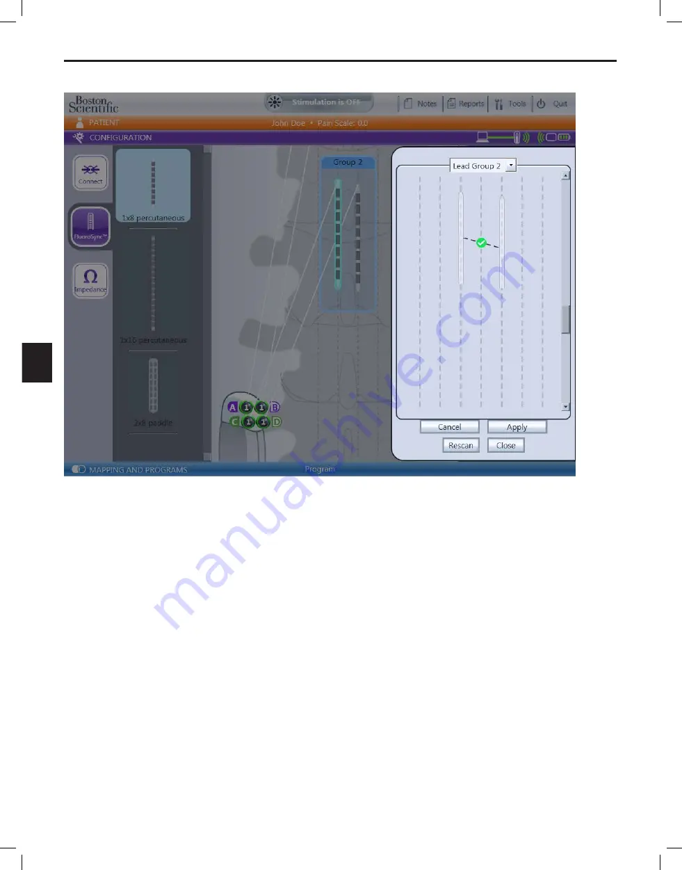 Boston Scientific Bionic Navigator 3d NM-7153-11A Скачать руководство пользователя страница 190