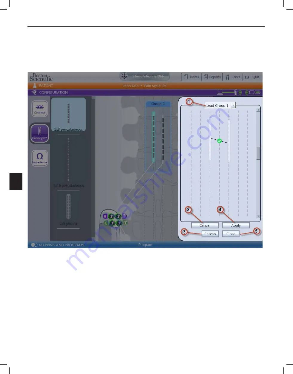 Boston Scientific Bionic Navigator 3d NM-7153-11A Скачать руководство пользователя страница 266