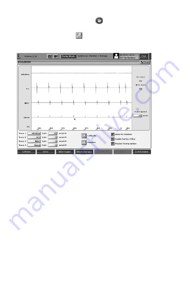 Boston Scientific Latitude 3300 Скачать руководство пользователя страница 32