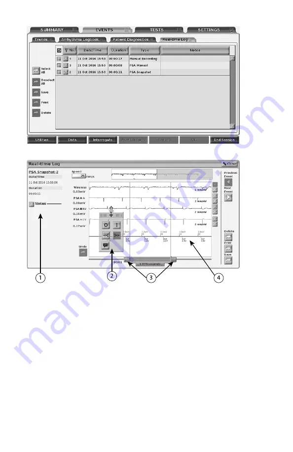 Boston Scientific Latitude 3300 Скачать руководство пользователя страница 46