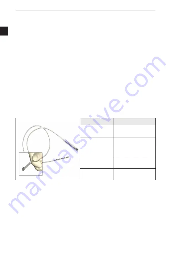 Boston Scientific NM-3138-55 Directions For Use Manual Download Page 40