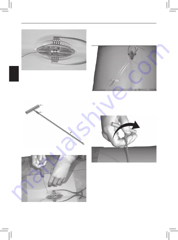 Boston Scientific Precision Spinal Cord Stimulator System Clinical Manual Download Page 106