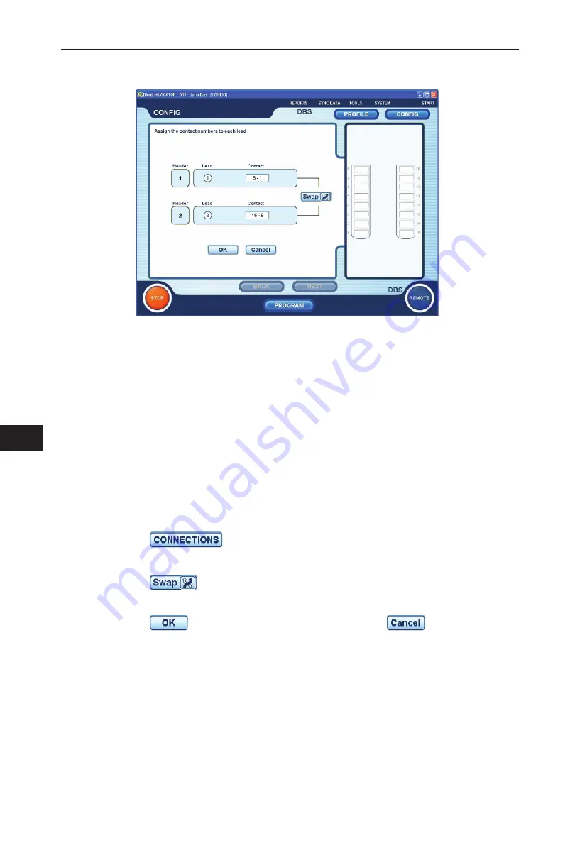 Boston Scientific VERCISE DBS Programming Manual Download Page 876