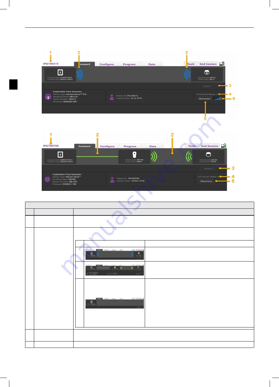 Boston Scientific Vercise Neural Navigator 4 Programming Manual Download Page 84